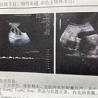 这是男宝女宝呀？