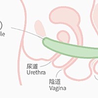 还有人不了解盆底肌是什么，在什么位置，有什么作用吗？在这边我就给大家普及一下这方面的知识吧。所有...