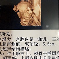 40 2终于见面了  七斤半的小朋友 怀孕状态胎心145一下120以上 孕吐断断续续一个月左右 不喜欢吃酸  肚子...