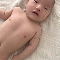 我的宝宝快四个月了，出生在大医院，出生的时候儿保科也检查了宝宝，怀孕的时候没有落下任何一项检查，...