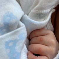 这小疙瘩是怎么回事，脚上也有