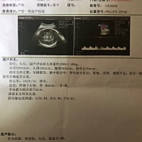 现在感觉，下腹下面酸酸的，还有屁股哪点也酸酸的，胎动下体感觉也很强烈
