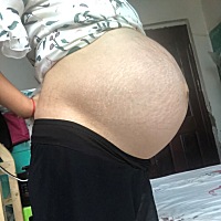 好着急，都超那么多天了，还是一点点动静都没有，有没有宝妈打过催生针的呀！