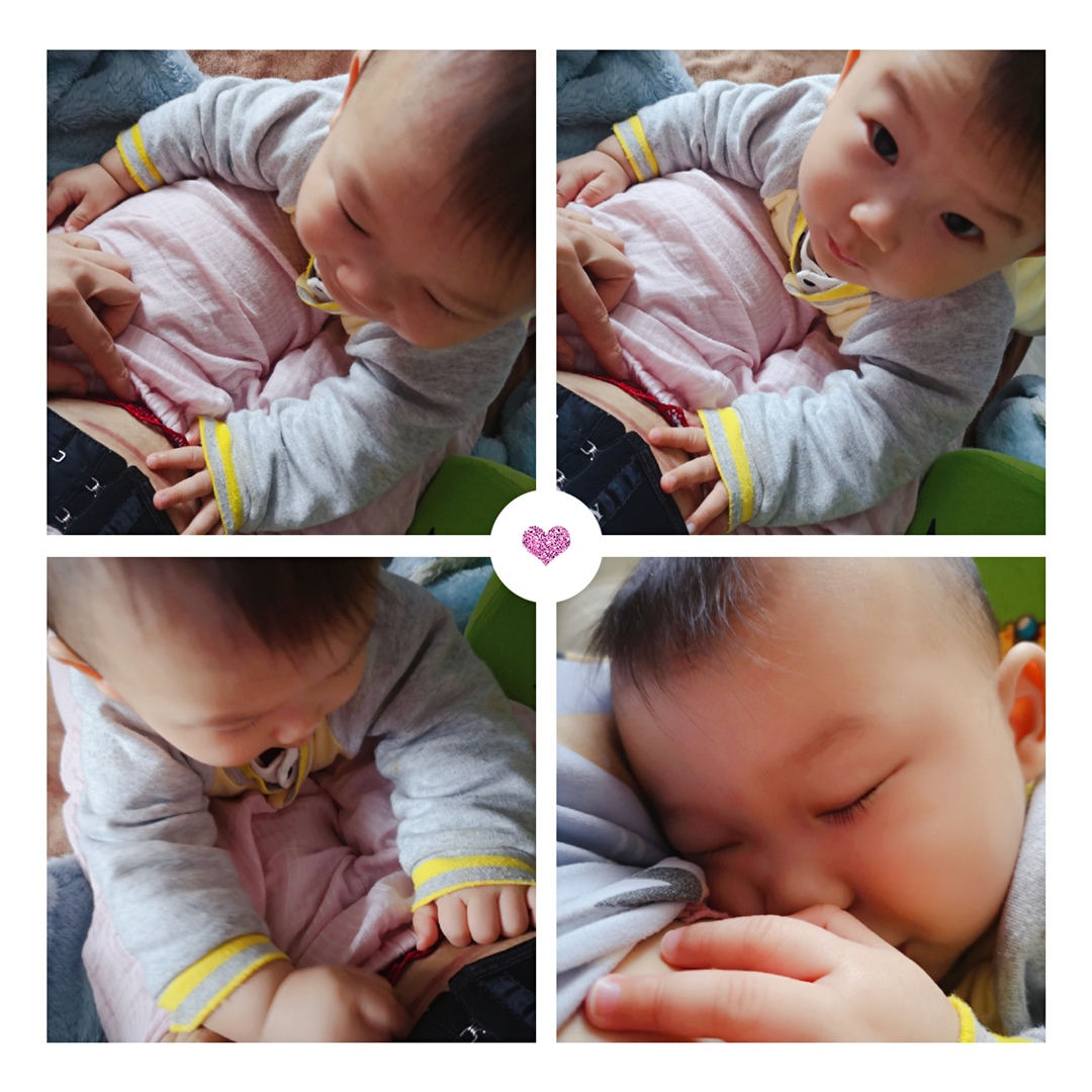 剖腹产伤疤特别深😭😭留疤特别大。好难过