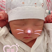 双胎孕妈孕晚期肝功能异常，肾积水，37➕4卸货一对可爱女儿，双胞胎妈妈太不容易了，以后所有都希望宝宝...