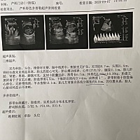 可以看懂，男孩女孩吗？