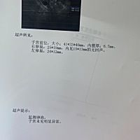 求助 有没有妹子会看超生报告单的？这是排了吗？ 9.6医生说15×13有点小 再等两天来测 9.8来测 医生说排...
