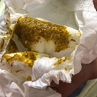 宝宝第四天了突然拉粑粑变成这种颜色正常吗？