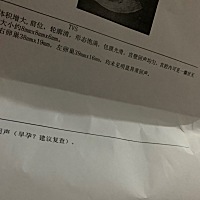 4月16号生的宝宝！今天去医院查出来怀孕30多天！可怜的孩子，我要对不起你了！
