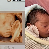 爱你 看着你 总会有一种如获至宝的感觉 四维大排畸 出来了也还是在肚子里的姿势 你太乖了 爸爸对你爱不...