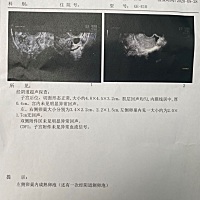 今天卵泡监测内膜0.4薄，医生建议明天继续监测一次，这种情况不是要调理好内膜在备孕吗？还是是说怀孕的...
