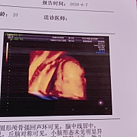 彩超跟生下来好像