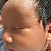 前几天很热 宝宝就长了这些痘痘今天第二天了 宝妈们你们知道这是怎么回事