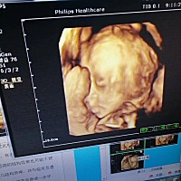 37加1刨腹产防弹衣一件