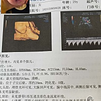 还没看出来像谁多一点！！！！