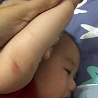 宝宝身上起了红斑，体温正常。今天我吃了辣椒，会不会是吃辣椒引起的？