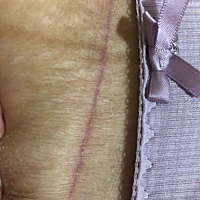 肚皮真是见不得人，连老公都不想让他看，又黑又囊，松垮垮的。