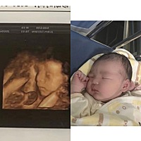 四维看鼻梁高的有点夸张哈哈哈、生出来还好；和四维比已经很还原了🤏动作都很像💓