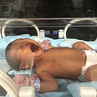 宝宝得了黄疸，看他照蓝光哭的好伤心，妈妈也难过😫，你好好在里面照顾自己。