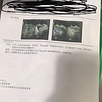 谁会看，快帮我看看是啥意思