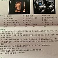 希望这胎是个女孩，凑个好，有会看的宝妈吗？