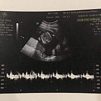 感谢大家帮忙看下男孩女孩