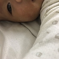 宝宝脸上这样白色的癣怎么能好快点，带去医院开了药，一个星期了并没有什么明显效果，有知道的宝妈求告...
