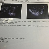 2020.10.5号下午来月经，这个月没来，测纸双杠，医生说到现在是42天，应该得宫内有孕囊，可是今天11月17...