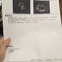 这个是几个月