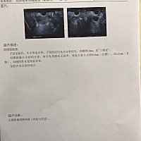 24号下午4-5点试纸测出强阳，持续到25号下午2点还是强阳，马上跑到医院监测，马上排卵了，要今晚和后天...