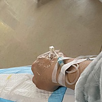 12.6号预产期  2号上午开始宫缩疼  到了晚上七点多  一直都是闷闷疼  我然后我家那个就说赶紧去医院  然...