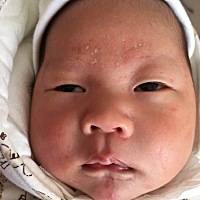 这是过敏吗？