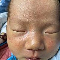 各位宝妈，请问这是长的什么呢？好今天了，不退，而且还越来越多了。