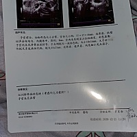 我才十八岁 上个月查出来的 有一边挺大的 还没有生过孩子 医生建议我住院打针 打针消不下去要做手术 我...