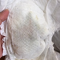 首先对不起视觉影响部分宝妈了。刚才突然发现宝宝尿不湿出现这个问题，不像便便，拆开尿不湿看看好像有...