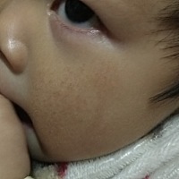 宝宝脸部很干燥，有点蜕皮，不知道买一种擦脸的，会比较好点