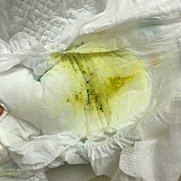 宝宝一个多月了，今天一天都在拉这种绿色粑粑，已经吃了一天的合生元益生菌了，没有改善，有宝妈遇到过...