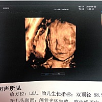 一路绿灯 🧡平安顺产我家女宝宝，6斤3两