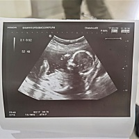 有点好奇，有会看的吗？