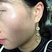 生完孩子以后长了很多斑 皮肤暗黄 现在总算变好了 开心开心😃