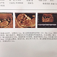 亲们能不能帮我看下男孩女孩呀