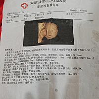 你们能看出来男孩女孩吗？