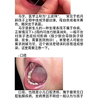 如出现白色糠疹建议到当地医院查血常规及微量元素、测量身高体重，排除贫血、微量元素缺乏、寄生虫等诱...