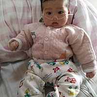 宝宝因为心脏空间隔缺损导致严重肺高压，肺炎好严重，医生给我签病危通知书时心都要崩溃了。医生说要做...