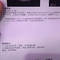 有什么办法