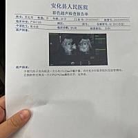 帮忙看看是男宝还是女宝呢