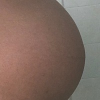 自己还是不太敢看伤口 恢复的也不太好