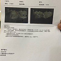 谁会看男女呀，刚怀孕三十多天做的孕囊，长方形的，是男孩女孩呀