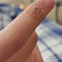 侧切伤口痛。产后宫缩恶露。开奶涨奶。又刺激宫缩！宝宝还在观察室