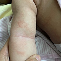 有没有宝妈知道这是什么，因为会痒的，宝宝有时候老扭来扭去，宝宝现在两个半！